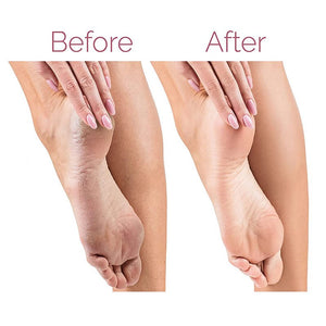 Electric Pedicure Foot File Callus Remover | مبرد قدم كهربائي لإزالة الكالو والعناية بالقدم